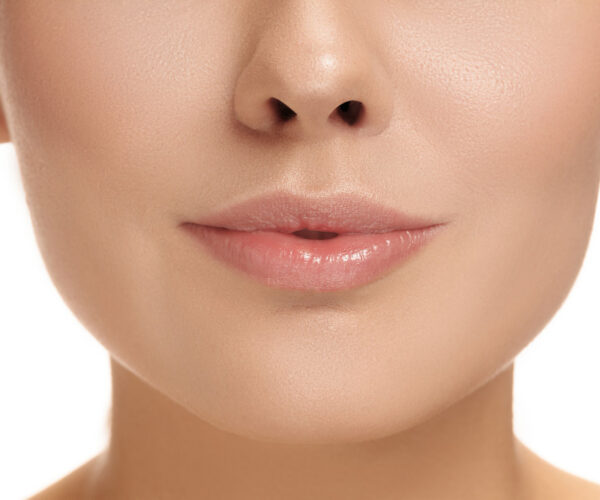 Lūpų putlinimas hialuronu