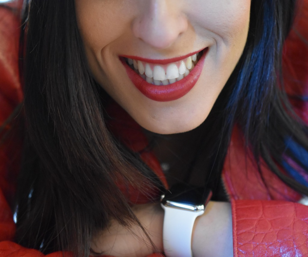 Šypsenos transformacija: ką privalu padaryti dar prieš sėdant į protezuotojo kėdę?